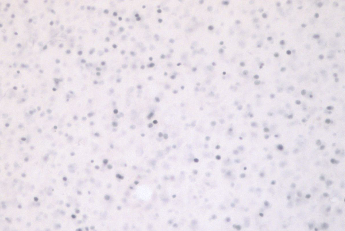 Photomicrograph of NCM showing immunostaining of the IEG Zenk
